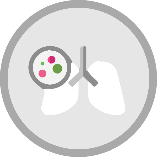Cáncer de pulmón